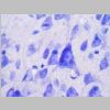 Neuronas Nissl 19.jpg